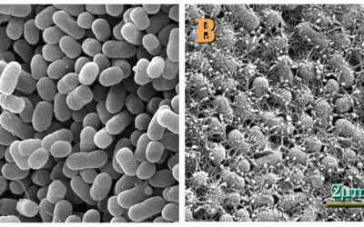 MedLab-Ratgeber: So schützen Sie Ihre Kinder vor EHEC