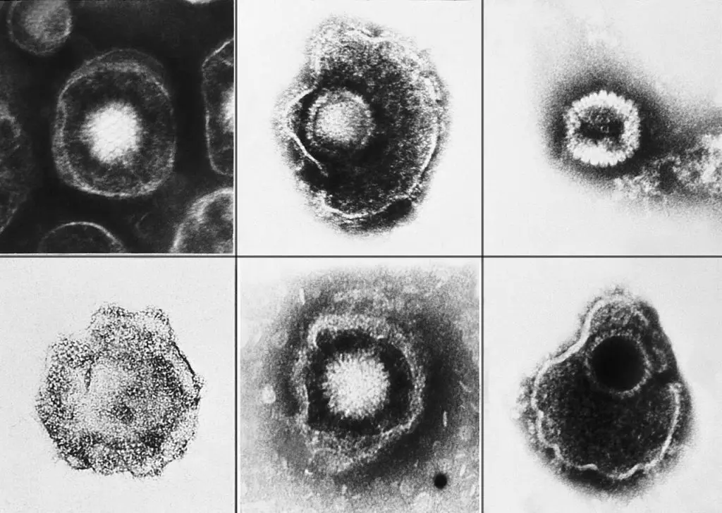 Verschiedene Viren aus der Familie der Herpesviridae. Zu diesen gehören Varizella-Zoster (Windpocken) und Herpes simplex Typ 1 und 2 (HSV-1, HSV-2). Credits: CDC / Wikipedia