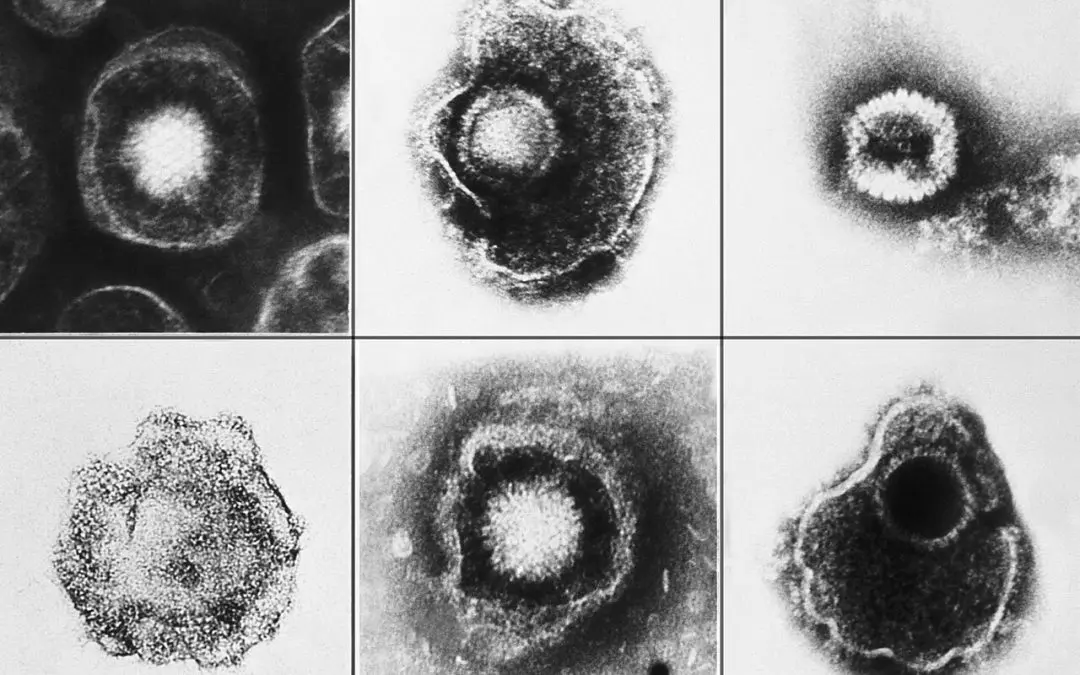 Hamburger und Göttinger Forschende entdecken Nanobody gegen Herpesvirus