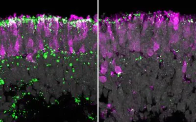 Humane Organoide: Gentherapie gegen Erblindung bei Kinderdemenz erfolgreich getestet