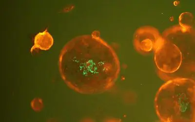 DFG fördert Forschungsverbund zu funktioneller Genomik und Mikrobiomik bei Darmkrebs