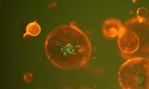 DFG fördert Forschungsverbund zu funktioneller Genomik und Mikrobiomik bei Darmkrebs