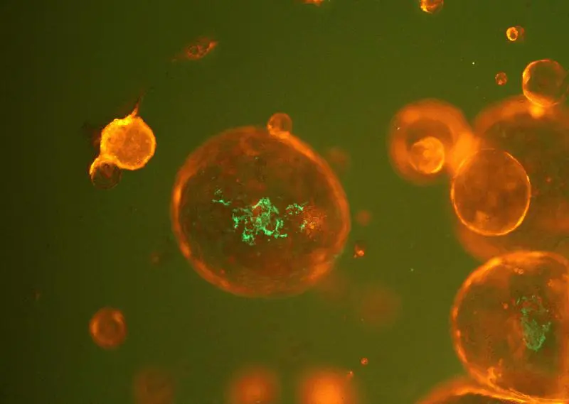 Krebs-assoziierte Bakterien (grün) werden in Tumor-Organoide (orange) injiziert, um detaillierte Einblicke in ihr Zusammenspiel zu gewinnen. | Copyright: Lena Schorr / Jens Puschhof 