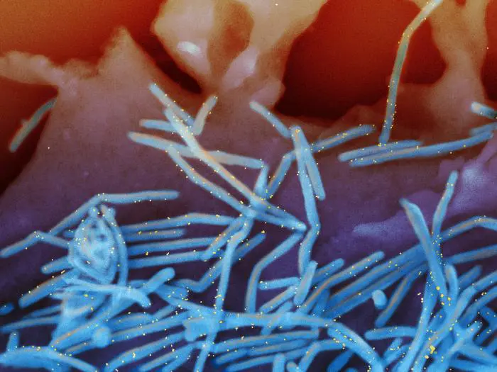 Human Respiratory Syncytial Virus (RSV). Credits: NIAID