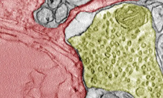 Krebszellen: Synapsenbildung mit Nervenzellen fördert Tumorwachstum