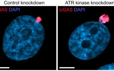 Schutzmechanismus ermöglicht Krebszellen das Überleben unter mechanischem Druck