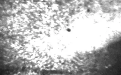 Bonner Forschende entdecken Mechanismus für postiktuales Umherwandern bei Epilepsie