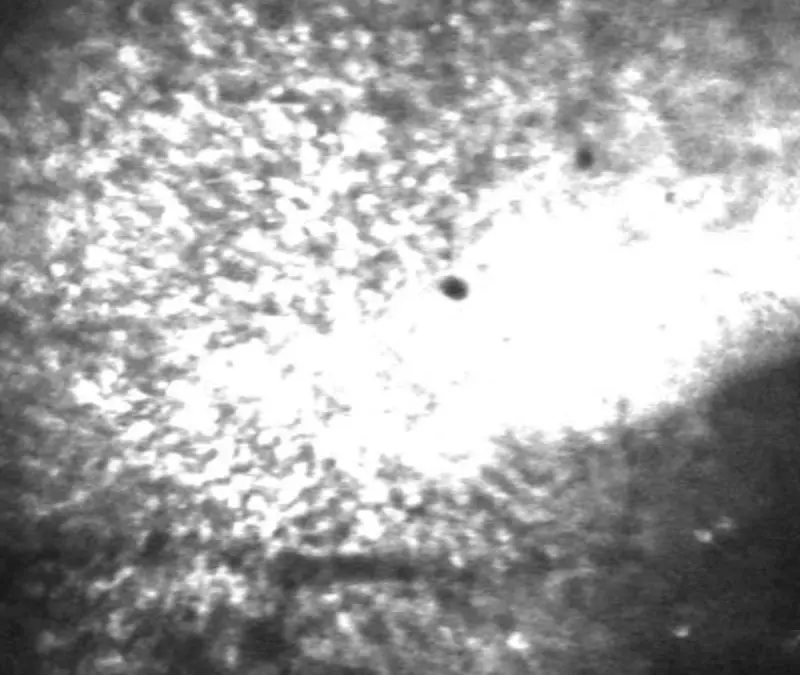 Bonner Forschende entdecken Mechanismus für postiktuales Umherwandern bei Epilepsie