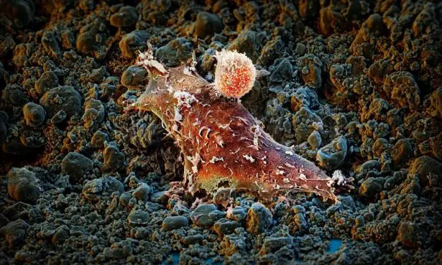 Neues Molekül könnte Krebstherapien revolutionieren