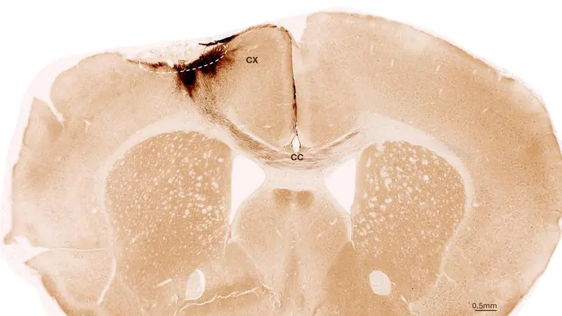 Koronaler Schnitt durch das Gehirn einer Maus nach einem Schlaganfall und der Transplantation neuronaler Stammzellen | Copyright: Universität Zürich 