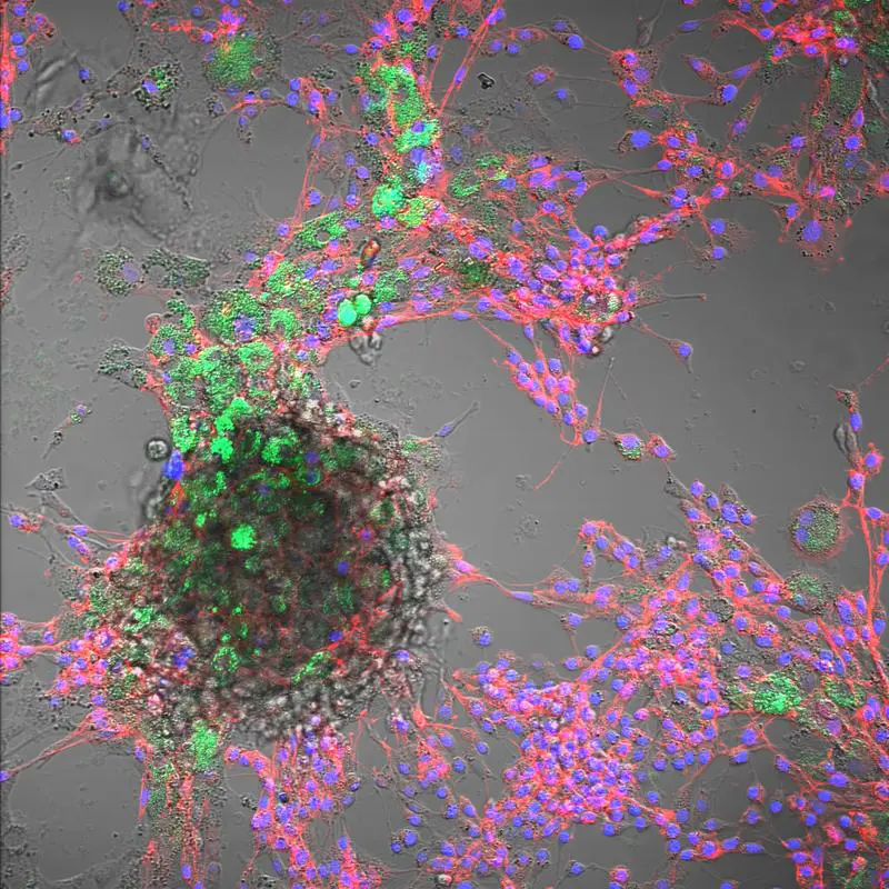 Kombinierte Hellfeld- und Fluoreszenzmikroskopie von Rinderzellen: Zellkerne (blau, DAPI), Cytoskelett (rot, Phalloidin) und aufgenommene Polystyrol-Nanoplastikpartikel (grün, 100 nm). | Copyright: FBN 