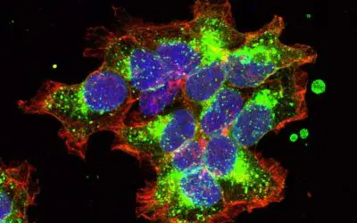 Patentiertes Verfahren aus Wien eröffnet neue Wege in der Brustkrebsforschung