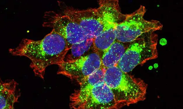 Patentiertes Verfahren aus Wien eröffnet neue Wege in der Brustkrebsforschung