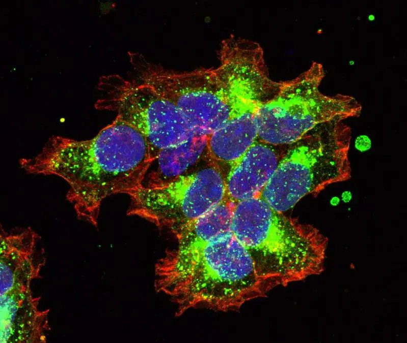 Patentiertes Verfahren aus Wien eröffnet neue Wege in der Brustkrebsforschung
