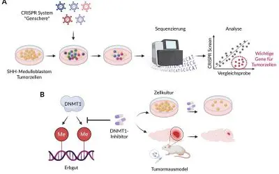 Tübinger Forschende entdecken Schwachstelle bei kindlichem Hirntumor