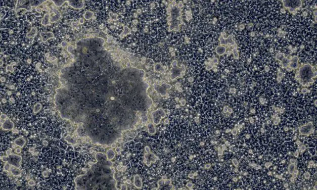 Fortschritt in der Stammzellforschung: Bessere Leberzellen durch Genmanipulation