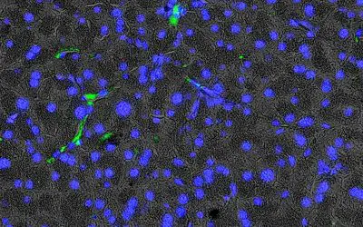 Neue Erkenntnisse zur altersbedingten Pankreasveränderung