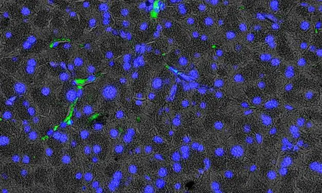 Neue Erkenntnisse zur altersbedingten Pankreasveränderung