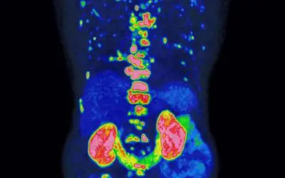 Preis für bahnbrechende Methode zur Prognose und Therapie von Prostatakrebs