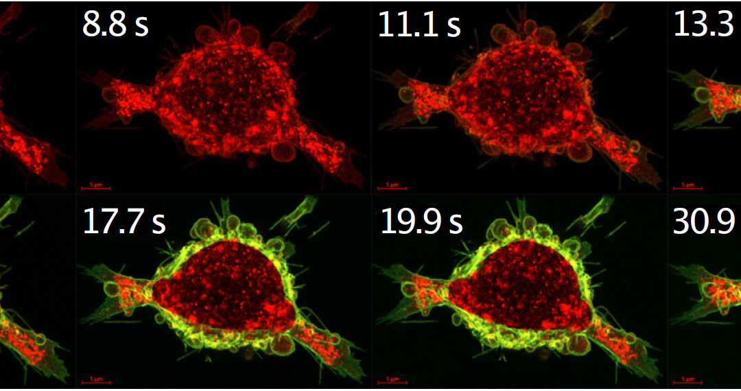 Calcium-sensitiver Schalter steigert die Wirksamkeit von Krebsmedikamenten