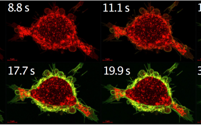 Calcium-sensitiver Schalter steigert die Wirksamkeit von Krebsmedikamenten