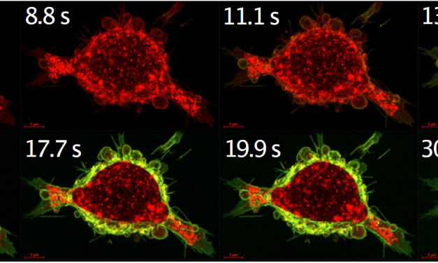 Calcium-sensitiver Schalter steigert die Wirksamkeit von Krebsmedikamenten