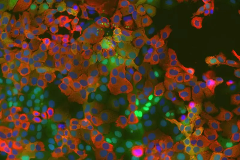 Zellkulturzellen, die einen Kinase-Aktivitätstreporter exprimieren (grün) nach Infektion mit dem humanen Coronavirus HCoV-229E (rot). Zellkerne sind blau gefärbt. | Copyright: © Molekulare und medizinische Virologie