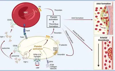 Düsseldorfer Team deckt gemeinsame Ursache für Thrombosen und Aneurysmen auf