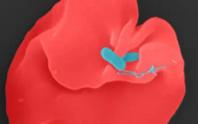 Aufklärung des Oroya-Fiebers eröffnet neue Therapieoptionen