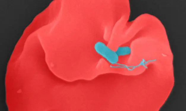 Aufklärung des Oroya-Fiebers eröffnet neue Therapieoptionen