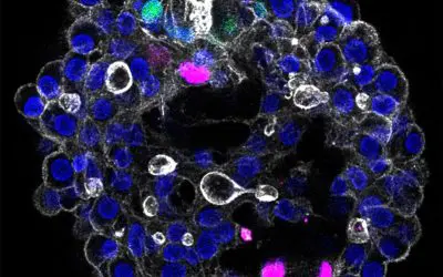 Bahnbrechend: Dresdner Team entwickelt modulares 3D-Modell der menschlichen Leber
