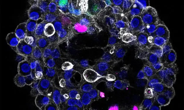 Bahnbrechend: Dresdner Team entwickelt modulares 3D-Modell der menschlichen Leber