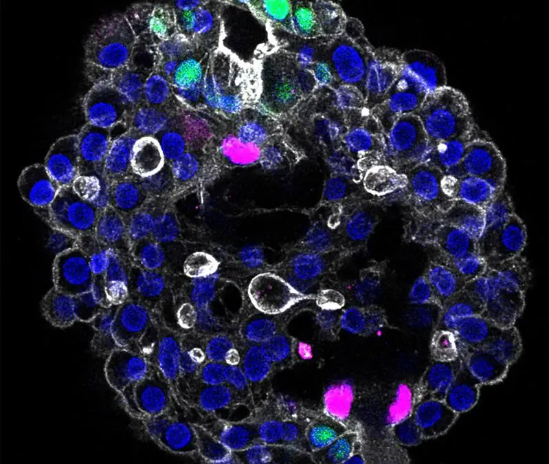 Bahnbrechend: Dresdner Team entwickelt modulares 3D-Modell der menschlichen Leber