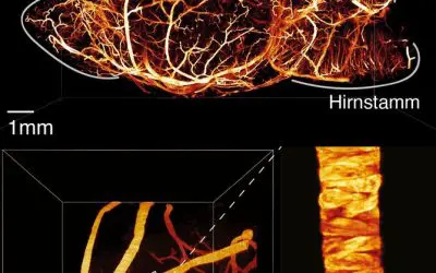 Forschungsteam optimiert Lichtblattmikroskopie für präzise 3D-Abbildungen