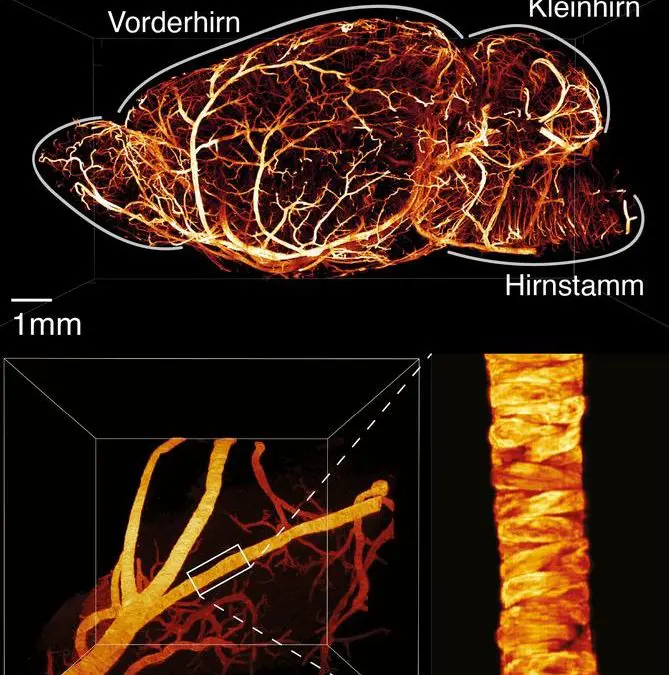Forschungsteam optimiert Lichtblattmikroskopie für präzise 3D-Abbildungen