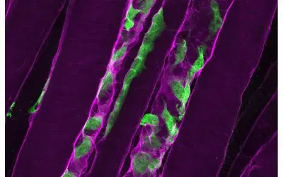 Uni Basel entdeckt neue Ansätze gegen schwere Muskelschwäche