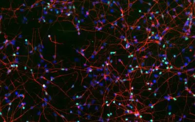 Neuer Schutzmechanismus gegen Demenz entdeckt