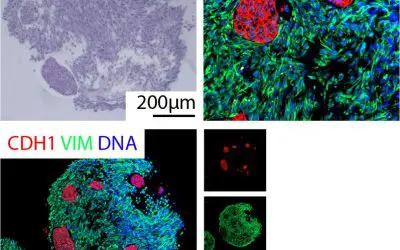 DFG fördert neues Graduiertenkolleg zu Tumor-Organoiden in Ulm