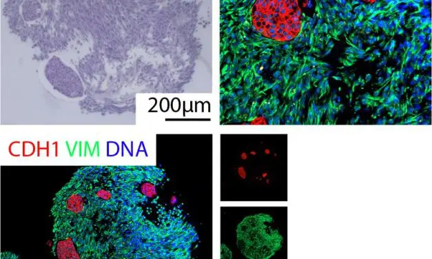 DFG fördert neues Graduiertenkolleg zu Tumor-Organoiden in Ulm