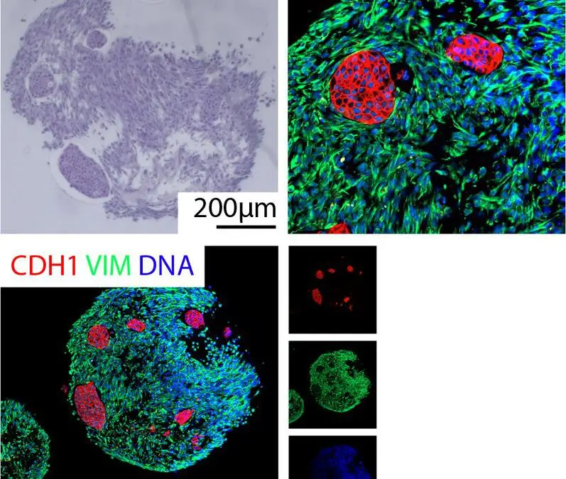 DFG fördert neues Graduiertenkolleg zu Tumor-Organoiden in Ulm