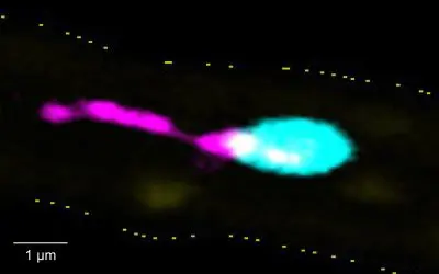 Würzburger Forschende entdecken entzündungsfördernden Mechanismus in Thrombozyten