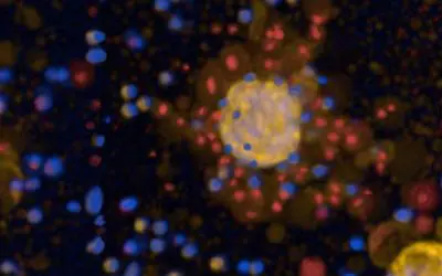 Tumoroide aus Lungenkrebsgewebe ermöglichen Test von Therapien