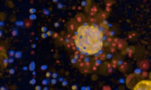 Tumoroide aus Lungenkrebsgewebe ermöglichen Test von Therapien