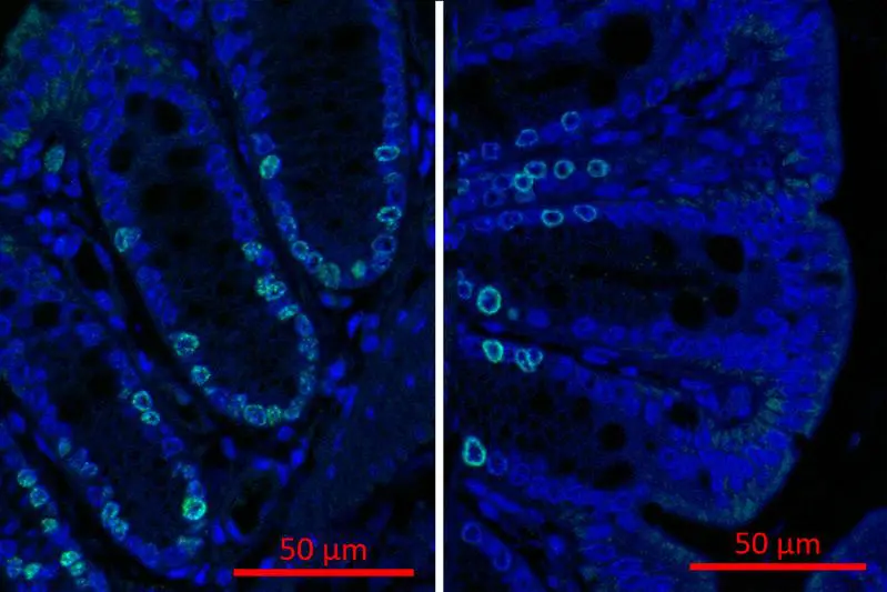 Immunfluoreszenz-Bildgebung des Proliferationsmarkers Ki67 im Dickdarm von gnotobiotischen Wildtyp-Mäusen, welche sekundäre Gallensäuren bilden können (rechts) oder nicht (links). | Quelle: Annika Oßwald | Copyright: DIfE