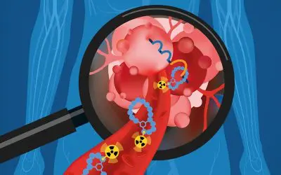 Blasenkrebs: Präzisionsdiagnostik mit Peptiden