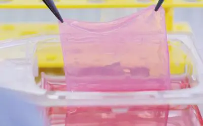 Crans Montana: Biotechnologisch gezüchtete Hauttransplantate für Verbrennungsopfer