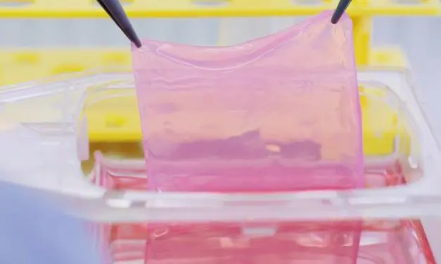 Crans Montana: Biotechnologisch gezüchtete Hauttransplantate für Verbrennungsopfer