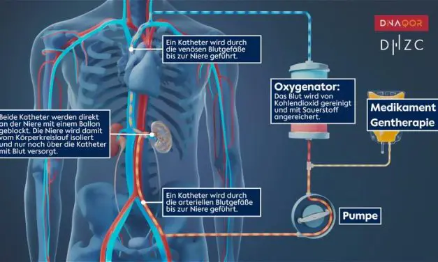 Forschende entwickeln System zur gezielten Behandlung einzelner Organe