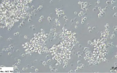 VORGESTELLT: Die weltweit größte Sammlung an Leukämie- und Lymphom-Zelllinien für die Krebsforschung