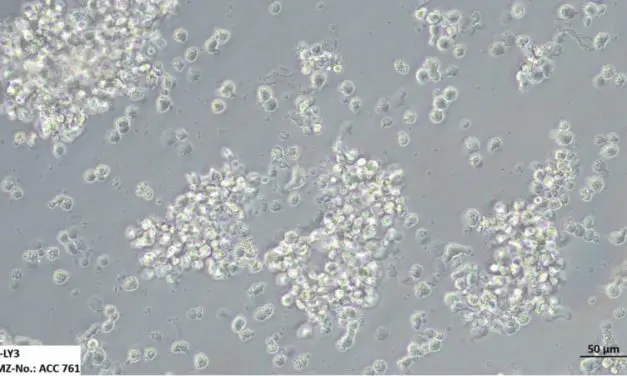 VORGESTELLT: Die weltweit größte Sammlung an Leukämie- und Lymphom-Zelllinien für die Krebsforschung